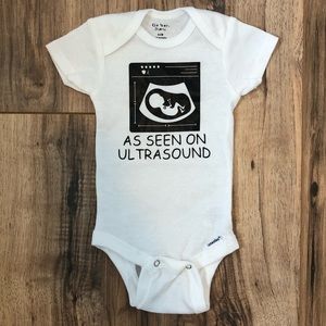 Custom onesie “As seen on Ultrasound”